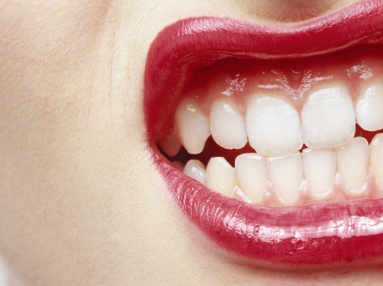 Is Stress Hurting Your Teeth?