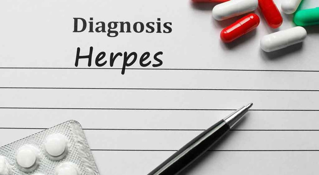 Genital Herpes Symptoms